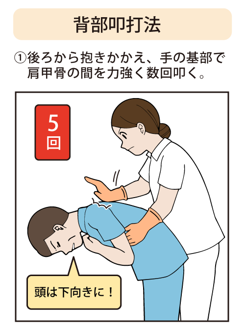背部叩打法：①後ろから抱きかかえ、手の基部で肩甲骨の間を力強く数回叩く。頭は下向きに！