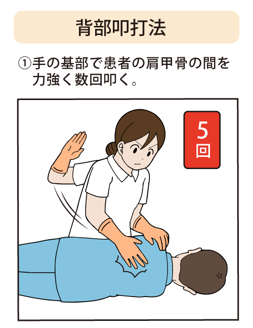 背部叩打法：①手の基部で患者の肩甲骨の間を数回叩く。