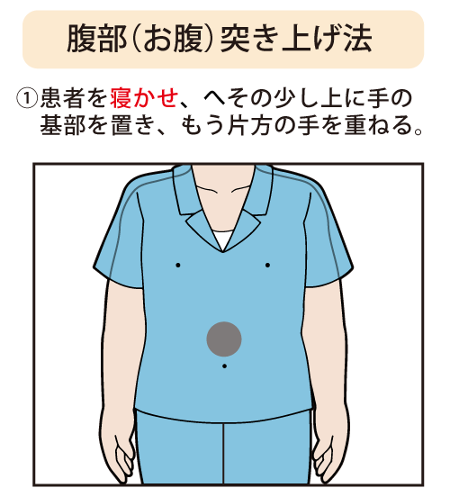 腹部（お腹）突き上げ法：①患者を寝かせ、へその少し上に手の基部を置き、もう片方の手を重ねる。