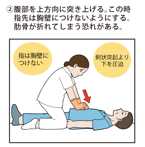 ②腹部を上方向に突き上げる。この時指先は胸壁につけないようにする。肋骨が折れてしまう恐れがある。