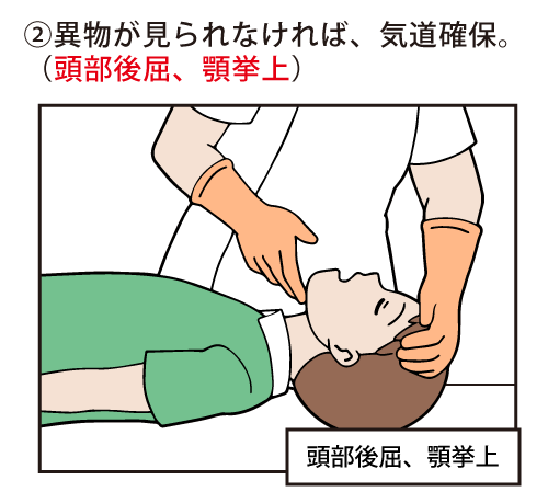 異物が見られなければ、気道確保。（頭部後屈、顎挙上）