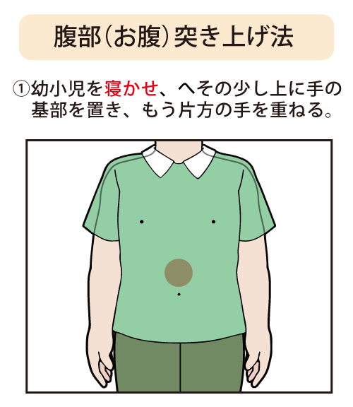 腹部（お腹）突き上げ法：①幼小児を寝かせ、へその少し上に手の基部を置き、もう片方の手を重ねる。